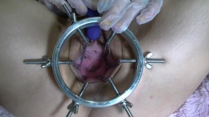 Open my pussy with ring spreader and orgasm